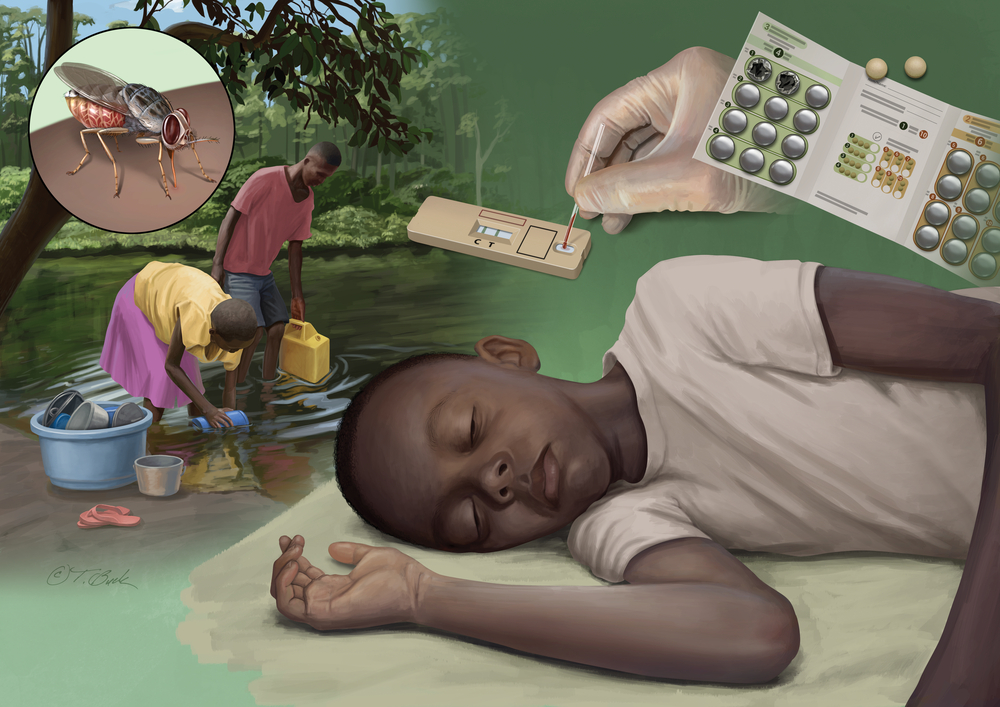 Enfermedad del sueño