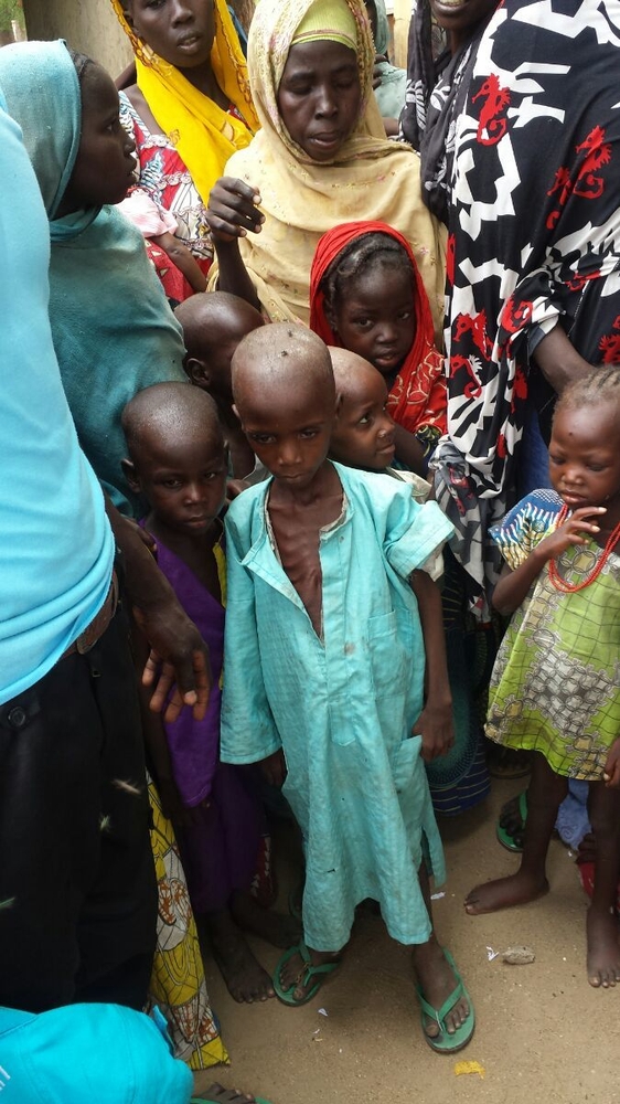 Displaced people in dire health situation in Bama