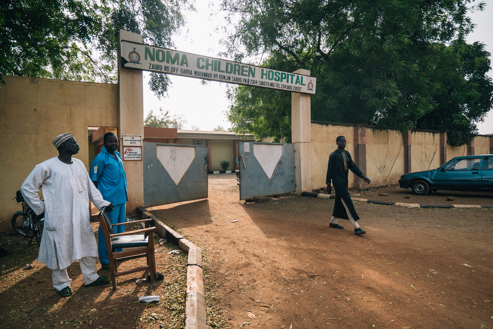 Sokoto Noma Hospital