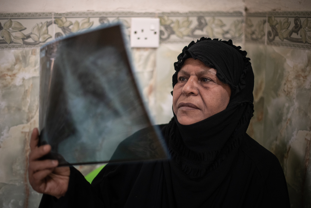 Hameeda mira una radiografía de sus pulmones, luego de su tratamiento exitoso para la tuberculosis multirresistente con medicamentos orales más nuevos. Bagdad, Irak, septiembre de 2021. ©MSF/CHLOE SHARROCK