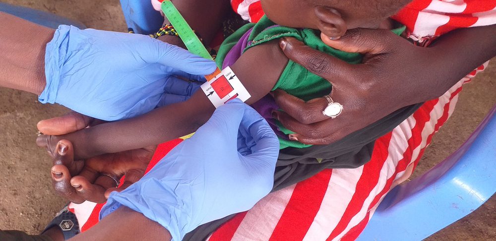 Crisis de desnutrición en Baidoa, Somalia
