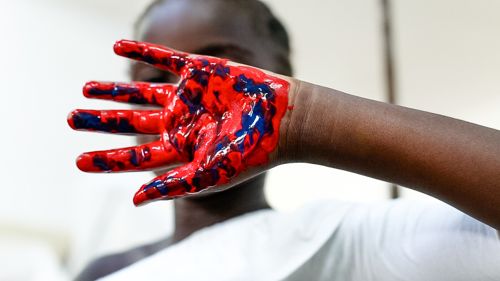 Un niño con VIH enuna actividad en una clínica de MSF en RDC.
