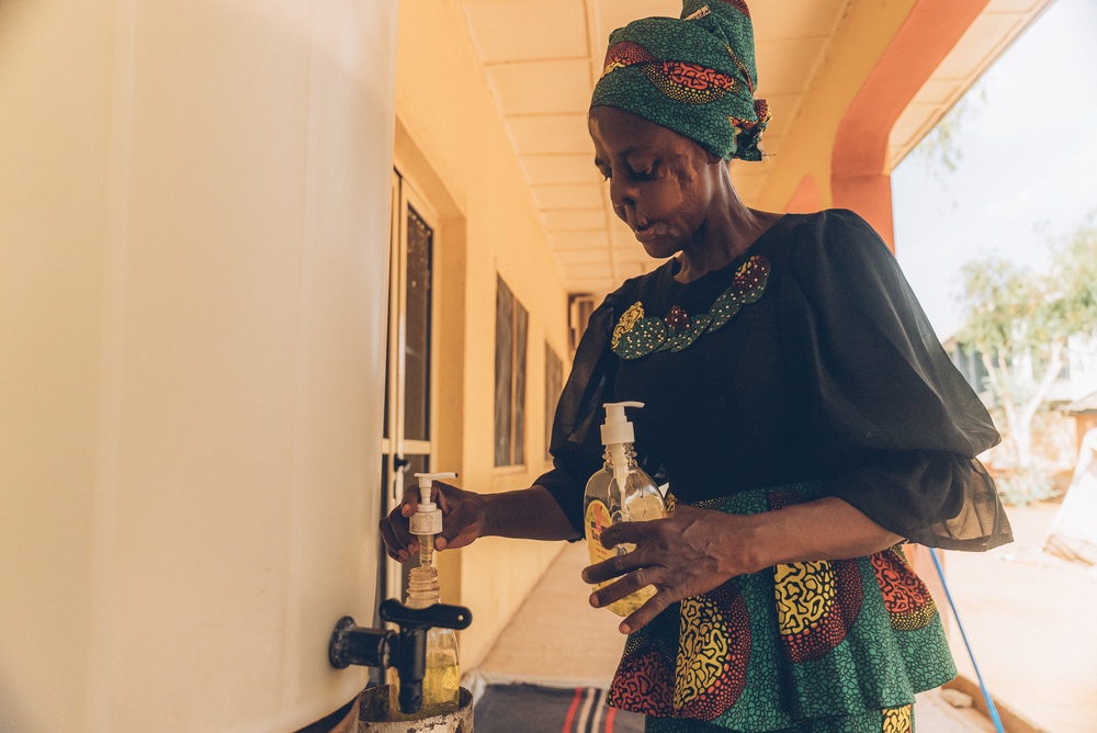 MSF brinda atención a pacientes con noma en el hospital de Sokoto, Ngeria