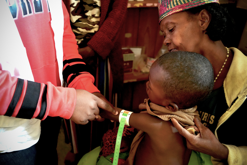 MSF brinda atención a niñoa y niñas con malaria y desnutrición en Madagascar