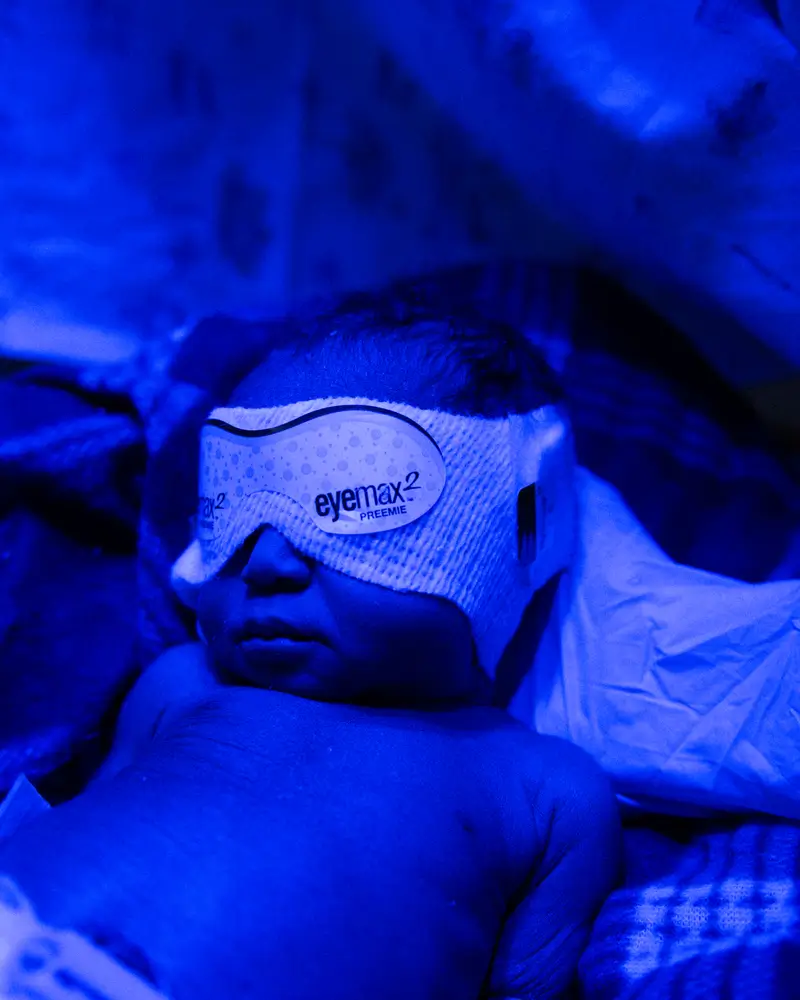 Un bebé prematuro está recibiendo fototerapia en el Hospital Nelifa Keji en Maiduguri, estado de Borno. Este hospital está gestionado en colaboración con el Ministerio de Sanidad del estado.