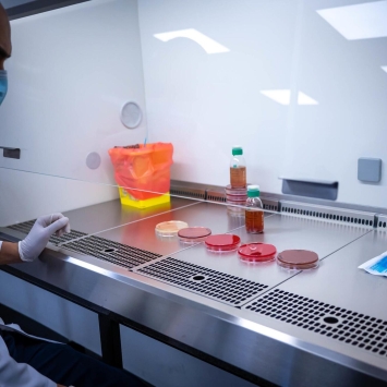 Un técnico de laboratorio en el hospital de cirugía reconstructiva de MSF en Amman, Jordania. Febrero 2022, © Soriya Tach