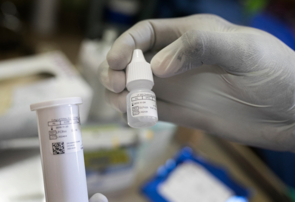 MSF apoya la decisión de impugnar las patentes de medicamentos contra el sida