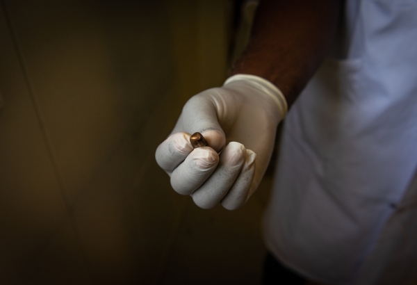 Un integrante de MSF muestra una bala extraída de un paciente que recibió un disparo en su vecindario. © Johnson Sabin