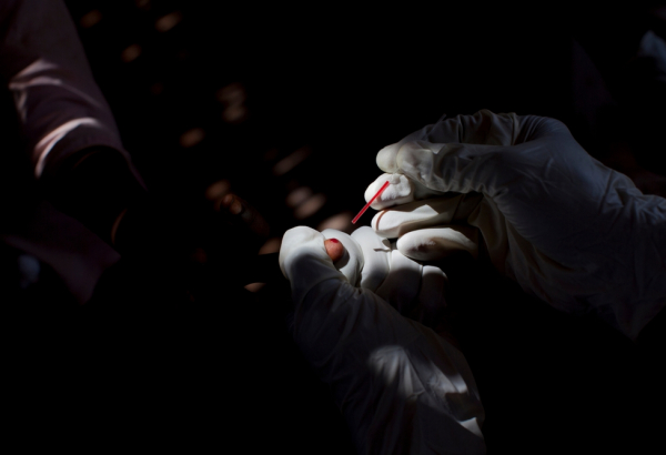 Human African Trypanosomiasis in DRC