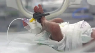 Recién nacido bajo seguimiento en la unidad de cuidados intensivos neonatales apoyada por MSF en el hospital Nasser,en Gaza.