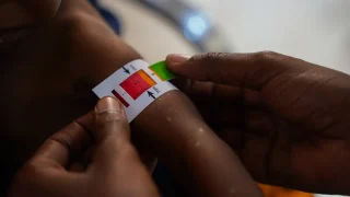 Niño con desnutrición en Baidoa, Somalia. Junio 2024. © Bishar Mayow/MSF