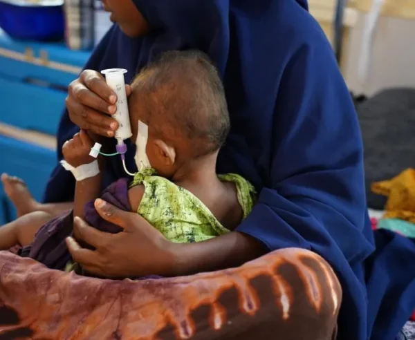 Una mujer sostiene a su hijo, quien sufre desnutrición, y le alimenta con una jeringa en el Hospital Bay Regional que apoyamos en Baidoa, en Somalia.
