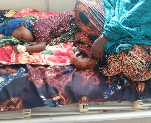 Halima Abdi Adan, ha vivido una pesadilla que ningún padre querría vivir: su hija de dos años, Ahlan, contrajo el sarampión cuando ya estaba debilitada por la desnutrición. Afortunadamente, tras una semana de cuidados intensivos, el estado de la niña mejoró.