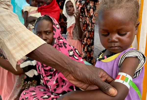 Un miembro del personal de MSF mide la circunferencia media del brazo (CMB) de Nouran Abdallah, de 2 años, quien huyó de El Fasher el 11 de octubre con su familia. La medición muestra desnutrición aguda moderada; será inscrita en el programa de la Clínica de Desnutrición Aguda Moderada en el campamento de desplazados de Dabaniera.