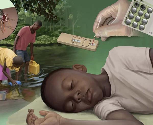 Niño con enfermedad del sueño, mosca tsé tsé, prueba rápida y medicación.