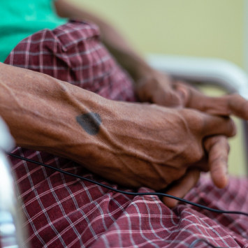 HIV Co-Infection Clinic - Yangon