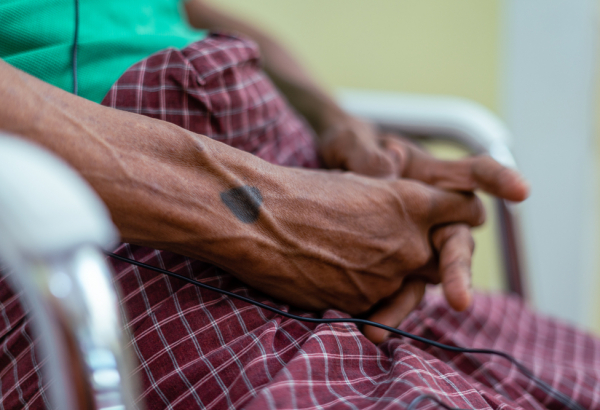 HIV Co-Infection Clinic - Yangon