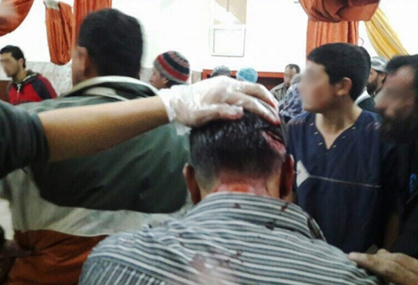 Barrel bombing of MSF Supported Hospital