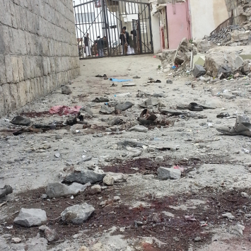 Yemen.Shiara hospital bleeding after attack.