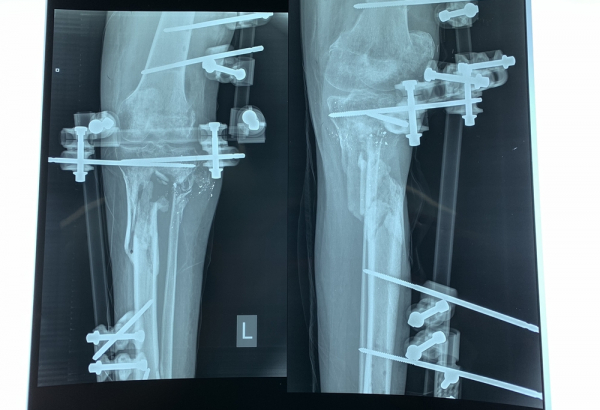 Surgeries in Al-Awda Hospital