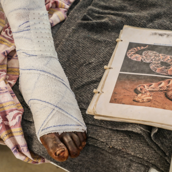 Arop Magut’s foot