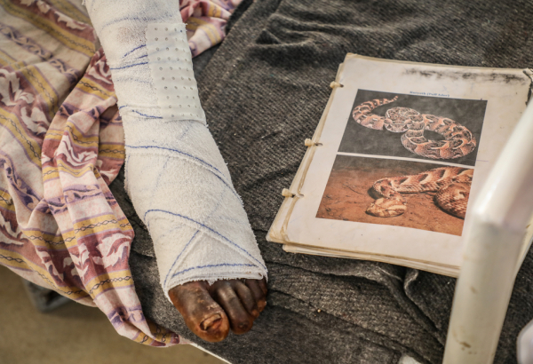 Arop Magut’s foot