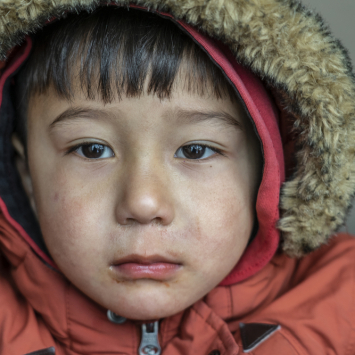 Children with Chronic diseases in Moria