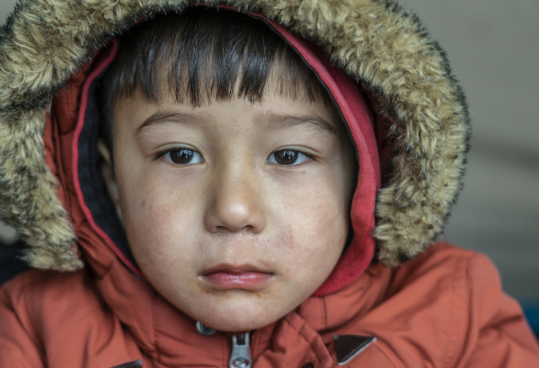 Children with Chronic diseases in Moria